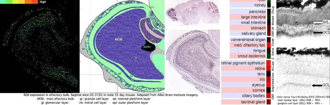 RGRsagittal.jpg